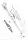 Fig. 15 - Electrode sheath for electrosurgical device
