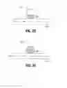 Fig. 04 - Apparatus and method of use for treating blood vessels
