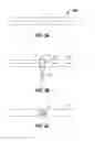 Fig. 07 - Apparatus and method of use for treating blood vessels