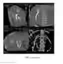 Fig. 02 - PATH CREATION USING MEDICAL IMAGING FOR PLANNING DEVICE INSERTION