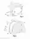 Fig. 03 - Patient-modified implant