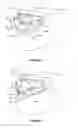 Fig. 02 - Dental implant framework