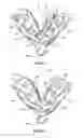 Fig. 03 - Dental implant framework