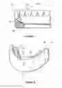 Fig. 05 - Dental implant framework