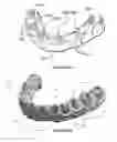 Fig. 07 - Dental implant framework