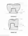 Fig. 13 - Dental implant framework