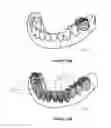 Fig. 16 - Dental implant framework