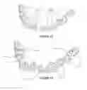 Fig. 17 - Dental implant framework