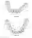 Fig. 19 - Dental implant framework