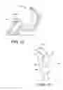 Fig. 08 - Devices and methods for securing an implant