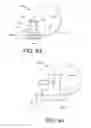 Fig. 23 - Devices and methods for securing an implant
