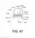Fig. 25 - Devices and methods for securing an implant