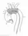Fig. 01 - Embolic protection device