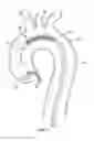 Fig. 03 - Embolic protection device