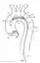 Fig. 07 - Embolic protection device