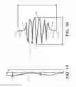 Fig. 02 - Monofilament implants and systems for delivery thereof