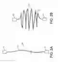 Fig. 03 - Monofilament implants and systems for delivery thereof