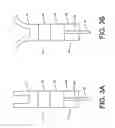 Fig. 04 - Monofilament implants and systems for delivery thereof