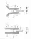 Fig. 05 - Monofilament implants and systems for delivery thereof