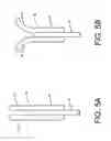 Fig. 06 - Monofilament implants and systems for delivery thereof