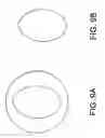 Fig. 12 - Monofilament implants and systems for delivery thereof