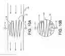 Fig. 13 - Monofilament implants and systems for delivery thereof