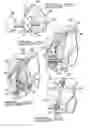 Fig. 05 - Apparatus And Method For Tibial Fixation Of Soft Tissue