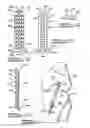 Fig. 06 - Apparatus And Method For Tibial Fixation Of Soft Tissue