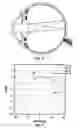 Fig. 08 - Ophthalmic devices that improve peripheral vision