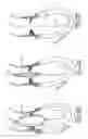 Fig. 14 - Collapsible prosthetic valve