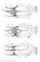 Fig. 15 - Collapsible prosthetic valve