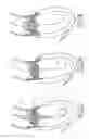Fig. 16 - Collapsible prosthetic valve