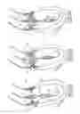 Fig. 18 - Collapsible prosthetic valve