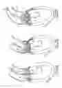 Fig. 19 - Collapsible prosthetic valve