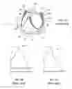 Fig. 02 - Replacement heart valves and their methods of use and manufacture