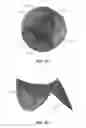 Fig. 15 - Replacement heart valves and their methods of use and manufacture