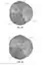Fig. 18 - Replacement heart valves and their methods of use and manufacture