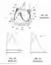 Fig. 02 - Replacement heart valves and their methods of use and manufacture