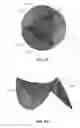 Fig. 15 - Replacement heart valves and their methods of use and manufacture