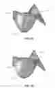 Fig. 17 - Replacement heart valves and their methods of use and manufacture