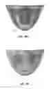 Fig. 20 - Replacement heart valves and their methods of use and manufacture