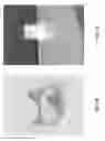 Fig. 24 - Replacement heart valves and their methods of use and manufacture