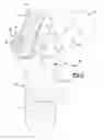 Fig. 04 - Modular Attachment Mechanism In Prosthetic Implants