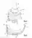 Fig. 05 - Modular Attachment Mechanism In Prosthetic Implants