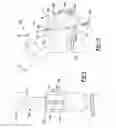Fig. 08 - Modular Attachment Mechanism In Prosthetic Implants