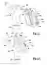 Fig. 09 - Modular Attachment Mechanism In Prosthetic Implants
