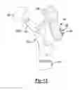 Fig. 10 - Modular Attachment Mechanism In Prosthetic Implants