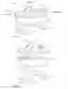 Fig. 02 - Total ankle replacement prosthesis