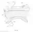 Fig. 04 - Total ankle replacement prosthesis