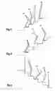 Fig. 04 - Combined active and passive leg prosthesis system and a method for performing a movement with such a system
